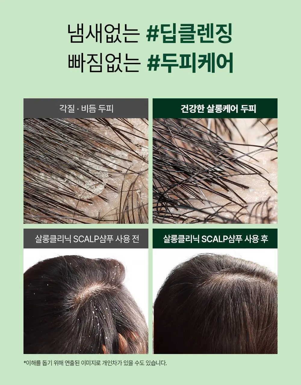 [각질/가려움] 박준뷰티랩 두피 클리닉 정수리 샴푸 500+200ml 두피샴푸 증정기획 상세페이지 16
